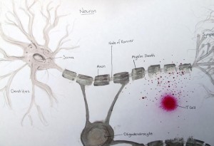 Neuron under attack